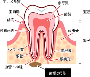 「歯根のう胞」って何だろう？